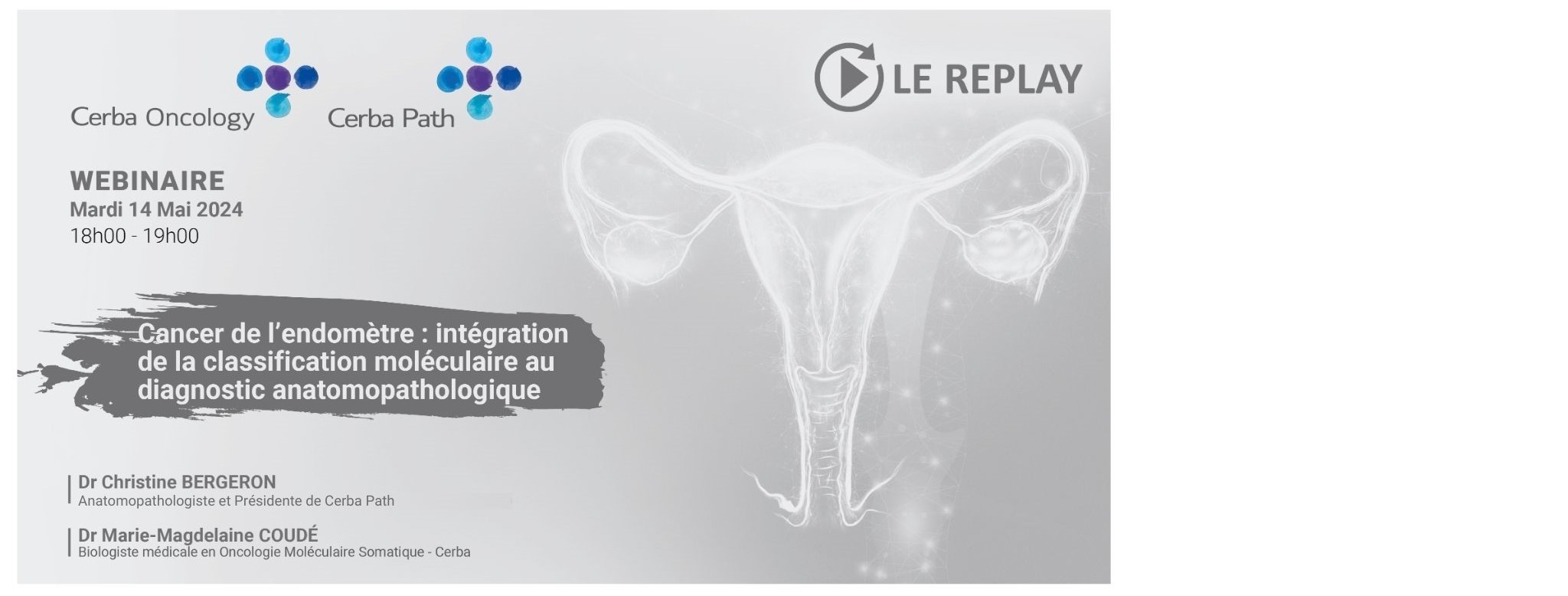 Endometrial cancer: integration of molecular classification into ...